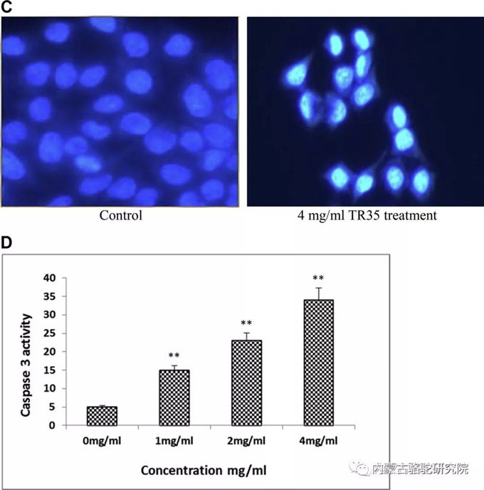 转录组学和蛋白质组学分析一种来自新疆双峰驼乳汁活性成分的TR35在食管癌细胞的抗癌机制